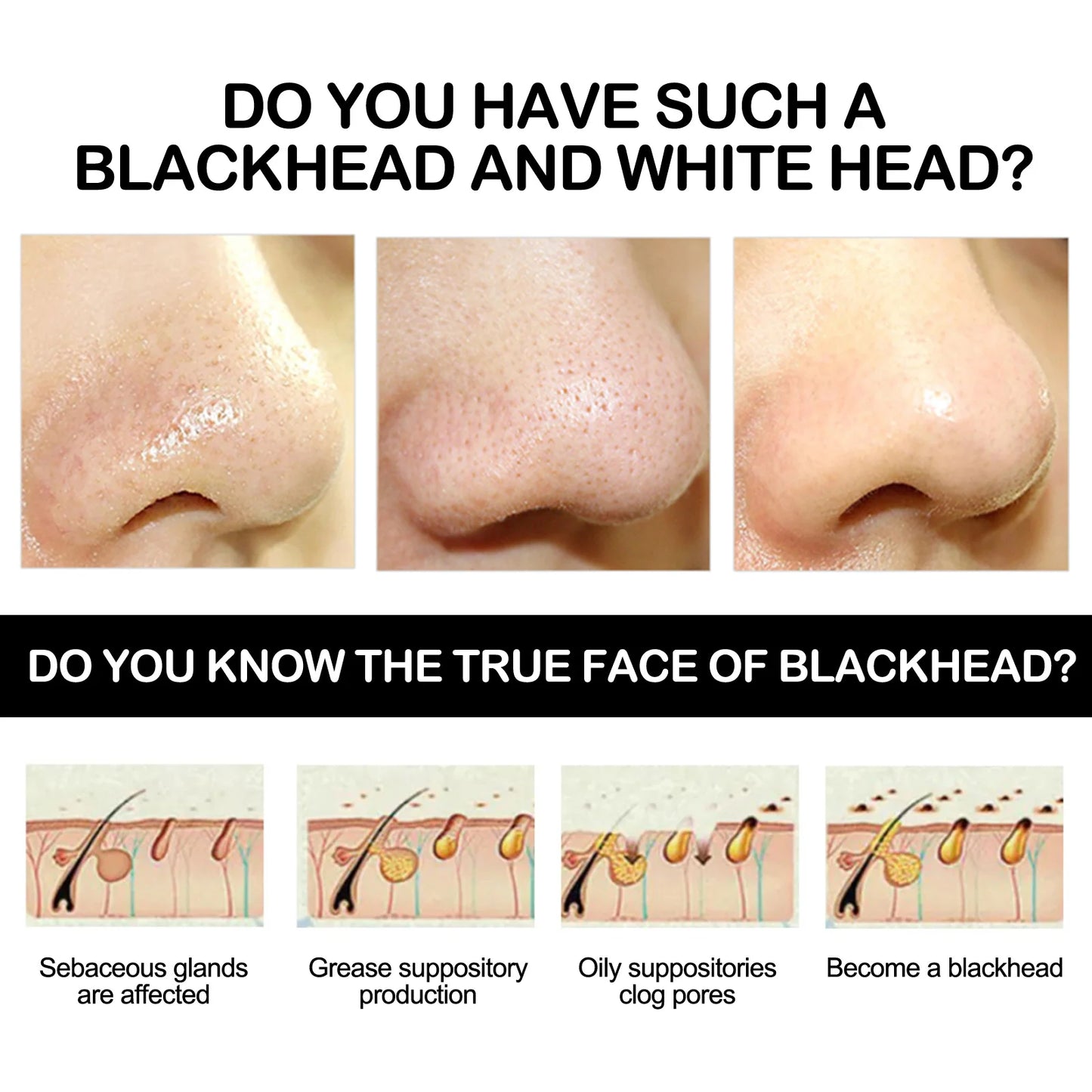 EELHOE Blackhead Remover Face Mask Oil-Control Nose Black Dots Peel off
